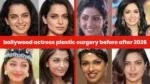 bollywood actress plastic surgery before after​